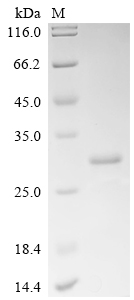 Recombinant Human Eukaryotic translation initiation factor 5B (EIF5B), partial