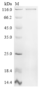 Recombinant Human Nuclear factor NF-kappa-B p105 subunit (NFKB1)