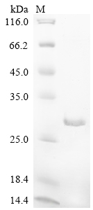 Recombinant Rat Heat shock protein beta-6 (Hspb6)