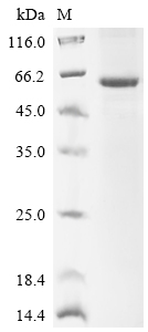 Recombinant Human Sphingomyelin phosphodiesterase (SMPD1)