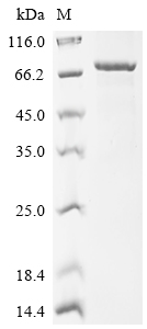 Recombinant Human Sphingomyelin phosphodiesterase (SMPD1)