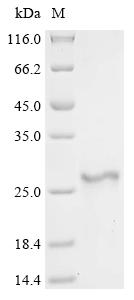 Recombinant Human Adrenodoxin, mitochondrial (FDX1)