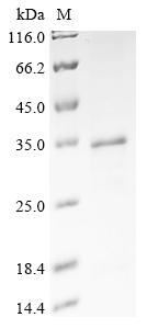 Recombinant Human A-kinase anchor protein 8 (AKAP8), partial