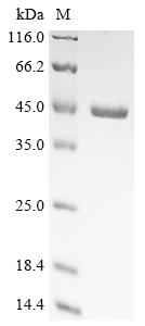 Recombinant Pseudomonas aeruginosa Type IV pilus biogenesis factor PilY1 (pilY1), partial