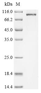 Recombinant Human Protein kinase C eta type (PRKCH)