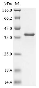Recombinant Human PRELI domain-containing protein 1, mitochondrial (PRELID1)