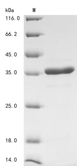 Recombinant Human DNA (cytosine-5)-methyltransferase 3A (DNMT3A)