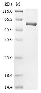Recombinant Human E3 ubiquitin-protein ligase ZFP91 (ZFP91), partial