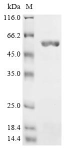 Recombinant Salmonella typhimurium Cell invasion protein sipD (sipD)