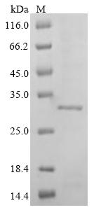 Recombinant Mouse Troponin I, cardiac muscle (Tnni3)