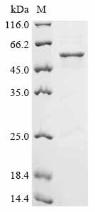 Recombinant Human Lupus La protein (SSB)