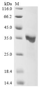Recombinant Pseudomonas aeruginosa Major outer membrane lipoprotein (oprI)