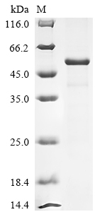 Recombinant Gossypium hirsutum Transcription factor bHLH84-like (LOC107908183)