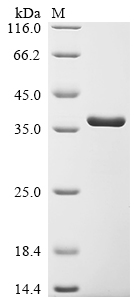 Recombinant Bacillus phage PBS2 Uracil-DNA glycosylase inhibitor (UGI)