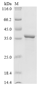 Recombinant Shigella flexneri Outer membrane protease icsP (icsP)