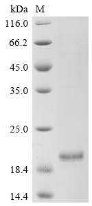 Recombinant Human Enhancer of yellow 2 transcription factor homolog (ENY2)