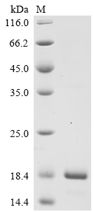 Recombinant Neisseria gonorrhoeae CDP-diacylglycerol--glycerol-3-phosphate 3-phosphatidyltransferase (NGK_0260), partial