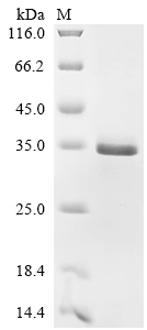 Recombinant Human Tissue factor (F3)