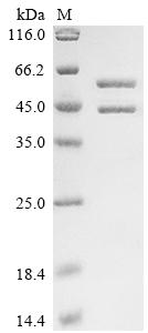Recombinant Streptococcus pyogenes serotype M1 C5a peptidase (scpA), partial