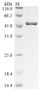 Recombinant Human Ataxin-7-like protein 3 (ATXN7L3)