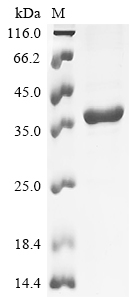 Recombinant Rat Synapsin-2 (Syn2), partial