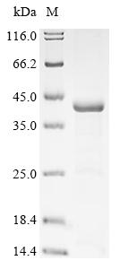 Recombinant Gossypium hirsutum Non-specific serine/threonine protein kinase (BIN2)