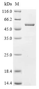 Recombinant Human Katanin p60 ATPase-containing subunit A1 (KATNA1), partial
