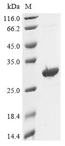 Recombinant Human Putative ATP-dependent RNA helicase TDRD12 (TDRD12), partial
