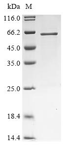 Recombinant Human Protein GOLM2 (GOLM2), partial