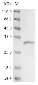 Recombinant Human Solute carrier family 22 member 1 (SLC22A1), partial