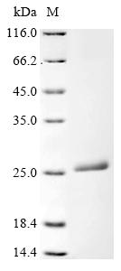 Recombinant Human Ferritin light chain (FTL)