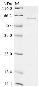 Recombinant Mumps virus Fusion glycoprotein F0 (F), partial