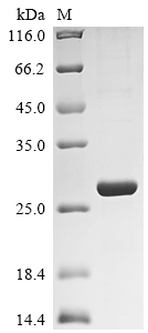 Recombinant Rat Retinol-binding protein 4 (Rbp4)
