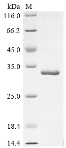 Recombinant Human Interferon alpha-2 (IFNA2)
