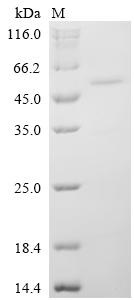 Recombinant Human Neuronal pentraxin-1 (NPTX1), partial