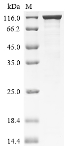 Recombinant Pig Glutamate carboxypeptidase 2 (FOLH1), partial, Biotinylated