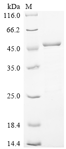 Recombinant Human Myosin regulatory light chain 12B (MYL12B)