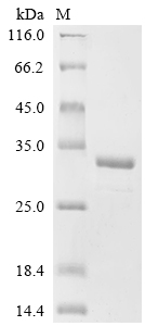 Recombinant Human Eukaryotic translation initiation factor 5B (EIF5B), partial