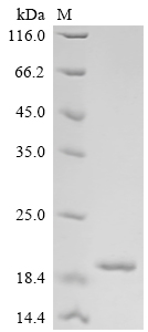 Recombinant Human Lymphocyte antigen 6K (LY6K)