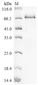 Recombinant Human Hydroperoxide isomerase ALOXE3 (ALOXE3)