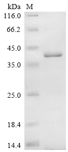 Recombinant Human Leukosialin (SPN), partial