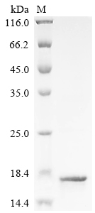 Recombinant Human T cell receptor beta variable 19 (TRBV19)
