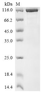 Recombinant Human Nuclear pore complex protein Nup85 (NUP85)