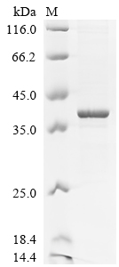 Recombinant Mouse Dexamethasone-induced Ras-related protein 1 (Rasd1)