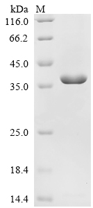 Recombinant Human Proteasome activator complex subunit 3 (PSME3)