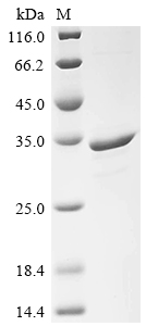 Recombinant Saccharomyces cerevisiae Heat shock protein 60, mitochondrial (HSP60), partial
