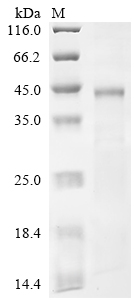 Recombinant Human Coagulation factor XII (F12), partial