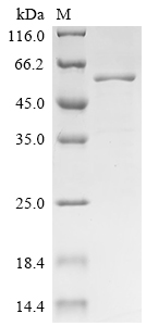 Recombinant Human Scaffold protein ILK (ILK)