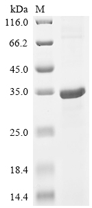 Recombinant Human Cathepsin W (CTSW)