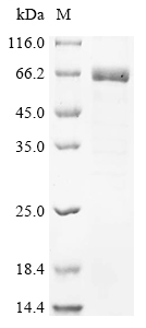 Recombinant Human Calcium/calmodulin-dependent protein kinase type II subunit delta (CAMK2D)